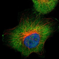 Aldolase A Antibody, Novus Biologicals:Anticorps:Anticorps primaires